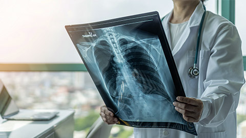 Doctor diagnosing patient’s health with radiological chest x-ray film for medical healthcare hospital service