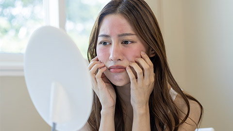 girl looking into mirror, allergy presenting an allergic reaction from cosmetic