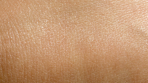 Closeup view of dry human skin