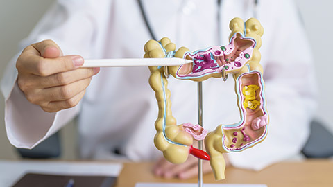 Doctor with human Colon anatomy model