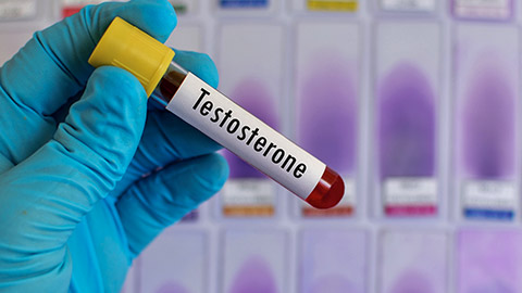 Blood sample for testosterone (male hormone) testing