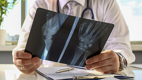 Male doctor hold in arm silver pen and look at xray photography