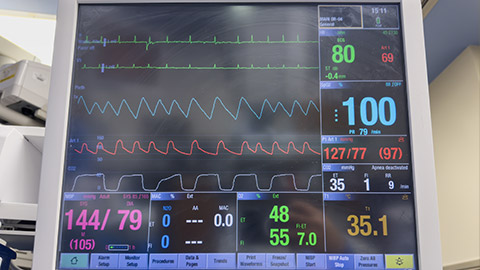 hospital monitor displaying vital signs, with medical staff in background, conveying urgency and healthcare professionalism