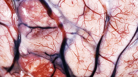 A close up shot of the blood vessels on brain surface