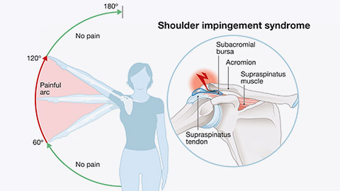 Range of motion diagram