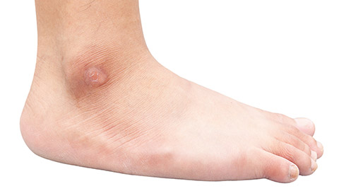 A close view of a human ankle