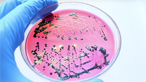 Close-up Black colonies of Salmonella bacteria that produce hydrogen sulfide growth on selevtive media XLD agar with white background while scientist hand holding