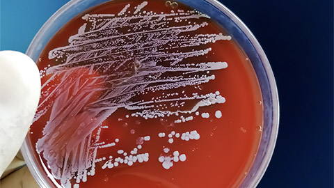 Staphylococcus aureus: Gram-positive, to Gram-variable, nonmotile, Coccus, beta hemolysis, saprotrophic bacterium that belongs to the family Staphylococcus growth on blood agar.