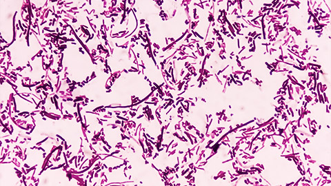 Salmonella typhi under a microscope