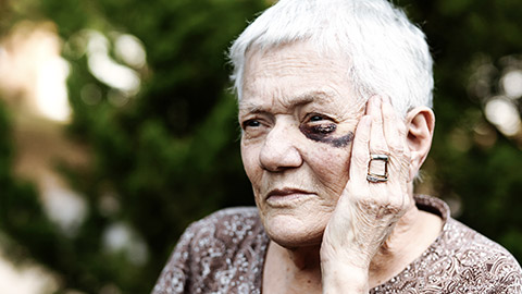 elderly woman with black eye