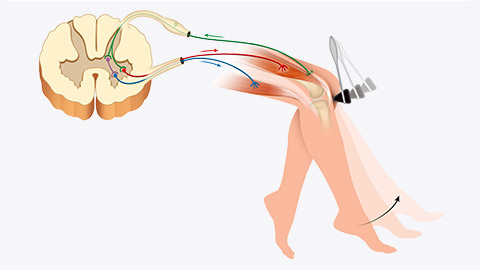 patella tendon reflex