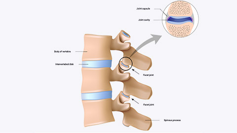 facet joints